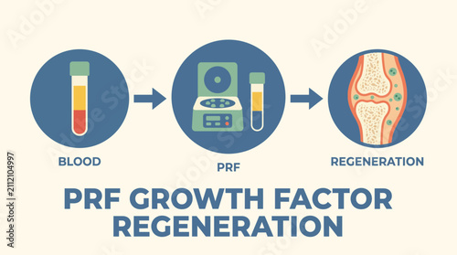 Fotografie Platelet Rich Fibrin PRF Growth Factor Regeneration