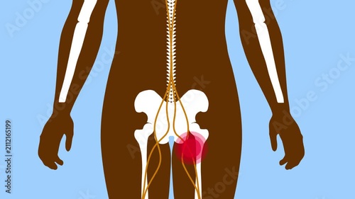 Human nerve pain tailbone pain and spinal disc disorder medical anatomy illustration