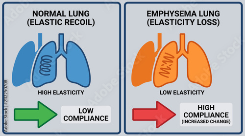 Canvastavla Lung Elasticity Loss in Emphysema and Lung Compliance Change
