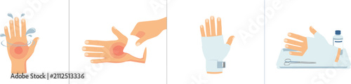 First aid step instructions for hand burn treatment with wound washing, cleaning, bandaging, and medical kit tools infographic chart elements