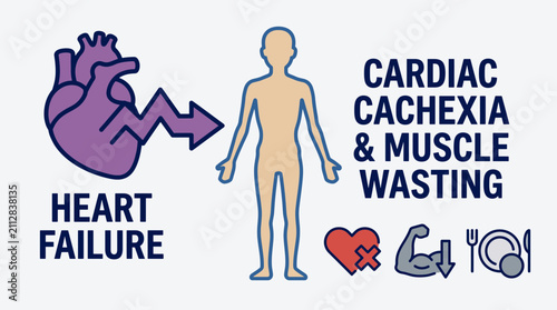 Bild auf Leinwand Heart Failure Cardiac Cachexia Muscle Wasting Illustration