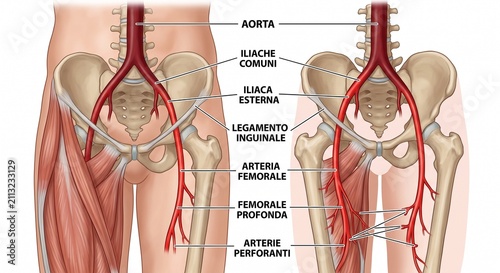 Arteria femorale.