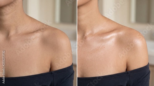 Before and after matte dull collarbone to glowing highlighted body care
