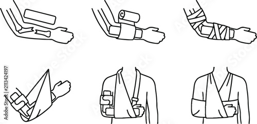Принти на полотні Step-by-step first aid illustration set demonstrating proper bandaging technique