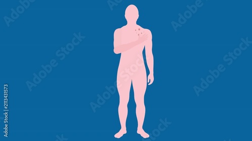 A person scratching itchy skin due to allergic rash fungal infection causing redness irritation and discomfort daily. 
