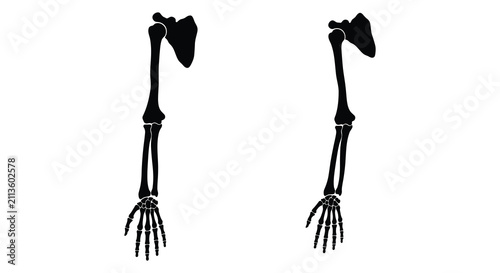 Fotografía Human arm skeletal structure in two poses black silhouette against a white backg