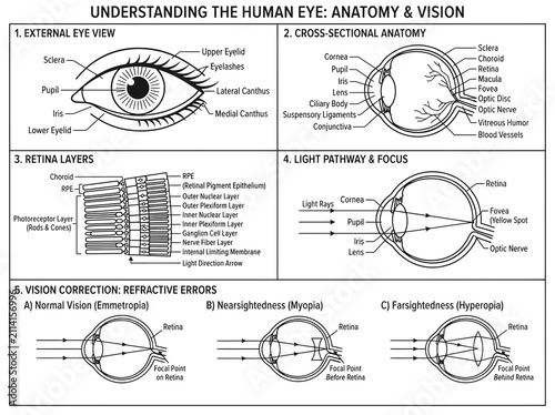Detailed medical diagram of human eye anatomy, vision pathways, and refractive error correction.