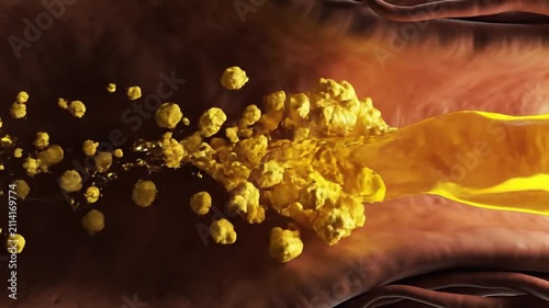 Golden oil washing away yellow cholesterol plaque in an artery for cardiovascular health
