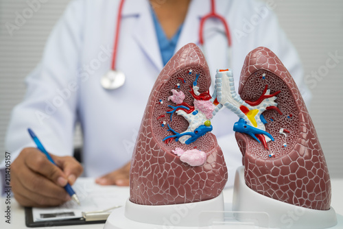 Konstfotografi Pneumonia, lung cancer, Asian doctor with human lung model.