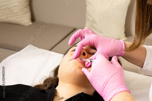 A picture of a very beautiful and attractive young lady showing the lip injection and rejuvenation process, in a professionally designed office. This look is very popular on the market, attracting