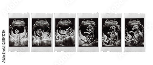 Dog ultrasound fetal development sequence showing puppy pregnancy growth stages, veterinary sonogram prints lined up in chronological order, animal gestation process medical scan display.