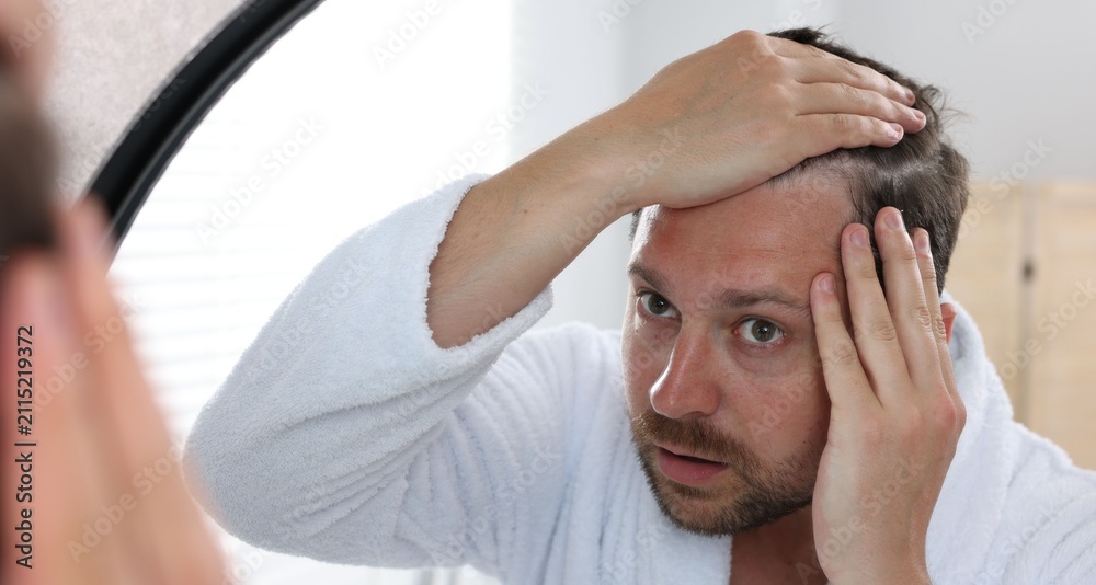 Фотография Dandruff problem