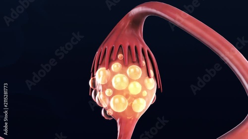 Female Reproductive System with Ovarian Cyst Formation Medical Animation