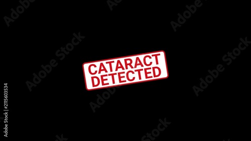 Cataract Detected Stamp Animation