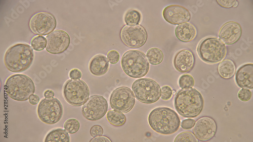 Microscopic yeast cell colony budding structure under laboratory magnification, showing spherical transparent organism cluster in close up biological science view