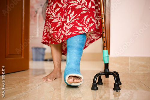 Broken leg