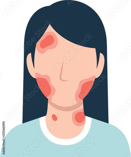 Foto Medical illustration of psoriasis affecting the face and neck, highlighting inflamed skin patches