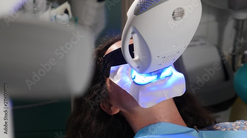 Close-up of a female patient undergoing a professional teeth whitening procedure with a UV lamp emitting bright blue light. Dental aesthetic treatment in a stomatology clinic 4k video