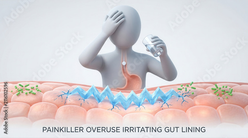 Illustration of painkiller overuse affecting gut lining and microbiome health with microbes and bacteria