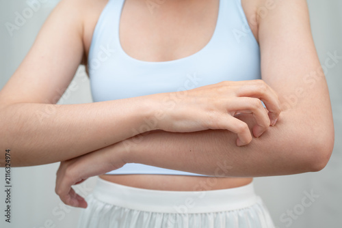 Foto Asian woman itching of skin diseases using hand scratching.