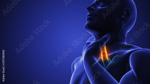 Cuadro en lienzo Sore Throat Pain and Inflamed Throat Medical Concept