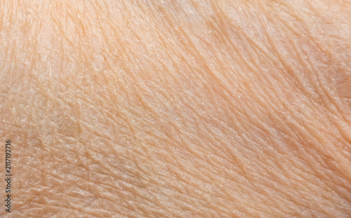 Cuadro en lienzo Macro texture of dry human skin, flaky epidermis closeup view, wrinkled body ski