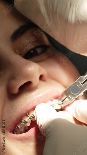 Orthodontist adjusting dental braces on patient