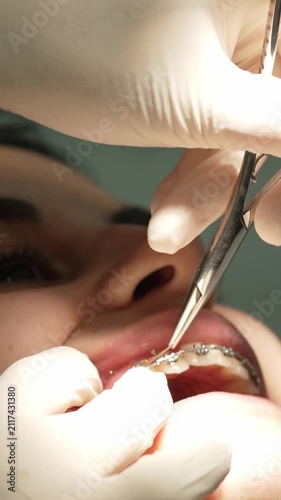 Orthodontist placing dental braces on patient's teeth