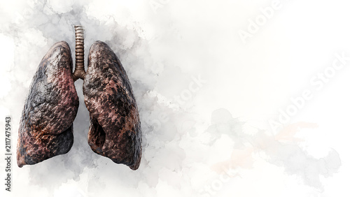 Medical 3D illustration of heavily damaged and diseased human lungs background is perfect for medical presentations, smoking cessation campaigns, and healthcare projects