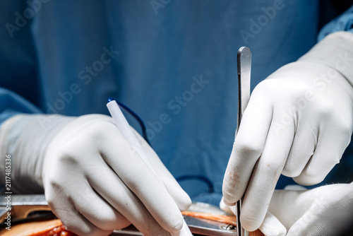Fotografie Surgeons’ sterile gloved hands using metal instruments directly within the surgi