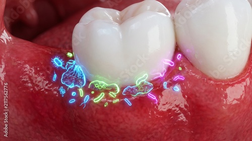 Close up of a human tooth with glowing bacteria and plaque buildup on the gums and enamel surface