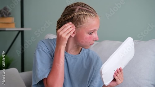Girl was burned in sun. Sunburn. The teenager has a red face.