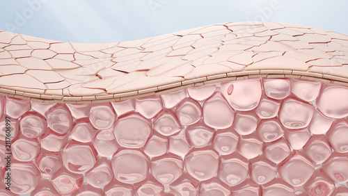Bild auf Leinwand human skin cell layers cracking and breaking down under ultraviolet UV light attack