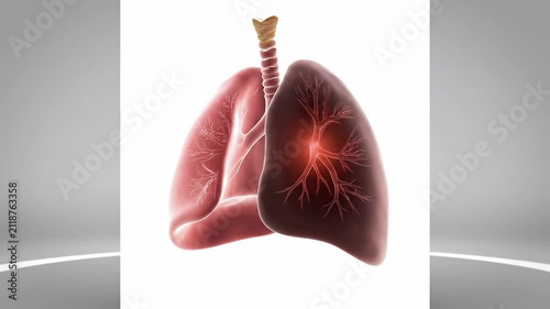 Human Lung Cancer Visualization Inside Glass Display for Medical Awareness
