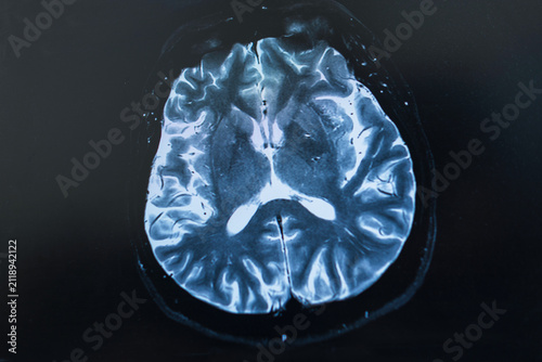 Fotografie A close-up shot of a human brain MRI or CT scan displayed on a monitor screen, showing detailed cross-section anatomy for medical diagnostics, neurology, and radiological analysis