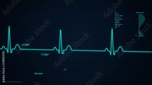 Abstract Medical ECG Heartbeat Telemetry Dashboard with Neon Cyan Pulse Waveform, Perspective Grid Floor, Cardiology HUD Data, and Health Monitor Analysis