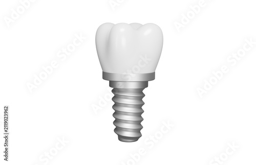 Dental implant 3d icon. Tooth replacement, implant dentistry and oral healthcare concept. Isolated 3D object.