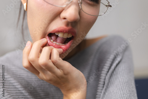 Foto Close-up of young woman checking painful mouth ulcer, representing oral health, canker sore, dental care, mouth pain, inflammation, hygiene, medical treatment and healthcare