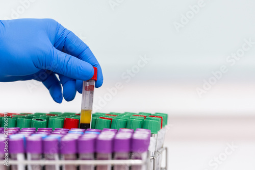 Konstfotografi Doctor hand holding blood test tube on white background for laboratory analysis