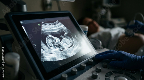 Sonogram of baby in womb, doctor's hands operate ultrasound machine