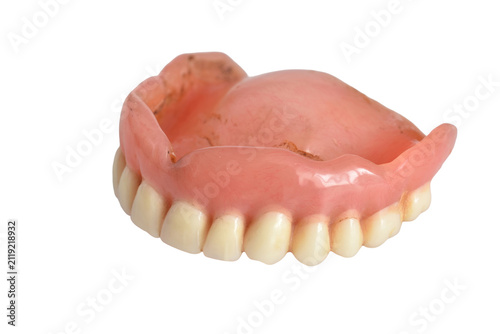 A complete removable denture for the upper jaw, consisting of artificial teeth and an acrylic plastic base that imitates gums.