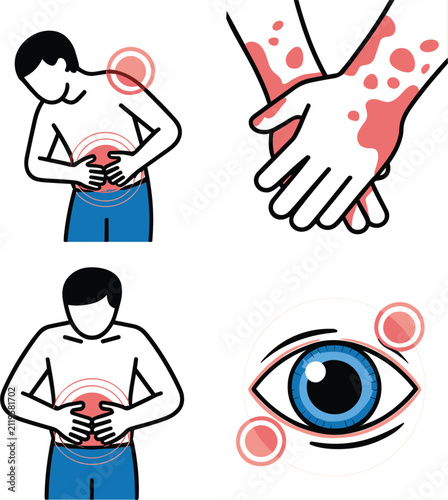 Medical Symptom Icon Set Featuring Abdominal Pain, Skin Rash, Eye Irritation, and Stomach Discomfort Illustrations for Healthcare and Clinical Infographics
