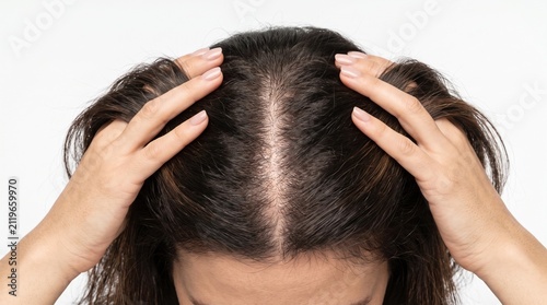 Woman parting hair to check for hair thinning or scalp health with self care thinning alopecia hairline dermatology