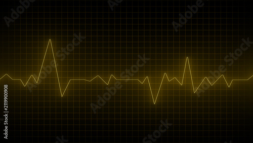 Yellow electrocardiogram waveform across a dark grid background heart rate pulse.