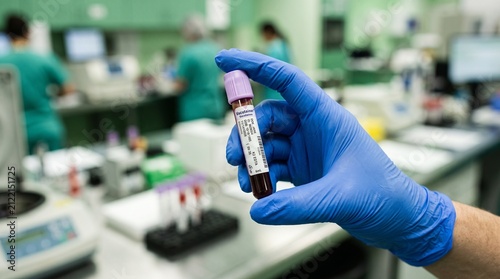 Medical researcher holding blood sample in laboratory.