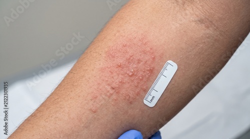Medical adhesive bandage on human arm close up view.