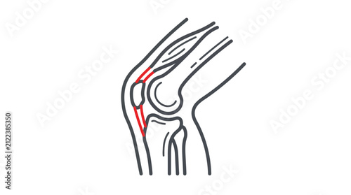 Detailed anatomical illustration showing human knee joint structure with highlighted red ligaments in vector art style