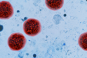 Papier peint photo Chambre d’enfants Close-up microscopic view of Cyclospora cayetanensis oocysts stained bright red. medical topics like cyclosporiasis outbreak, foodborne parasite infection, microbiology research. water pollution  © alones