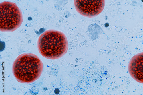Close-up microscopic view of Cyclospora cayetanensis oocysts stained bright red. medical topics like cyclosporiasis outbreak, foodborne parasite infection, microbiology research. water pollution