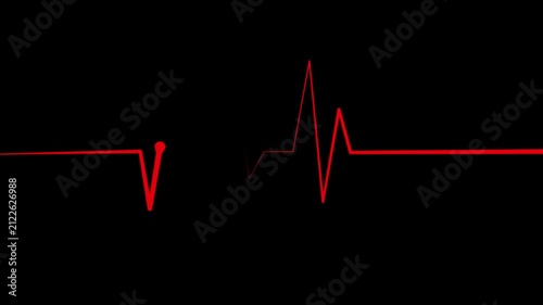 Ecg heartbeat line sharp pulse spike showing a medical monitor trace and a simple health care animation